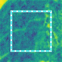 Aggregated distortion map (anisotropic)